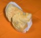 Mold, dental, dentist — Dental Procedures Made Easier With IV Sedation
