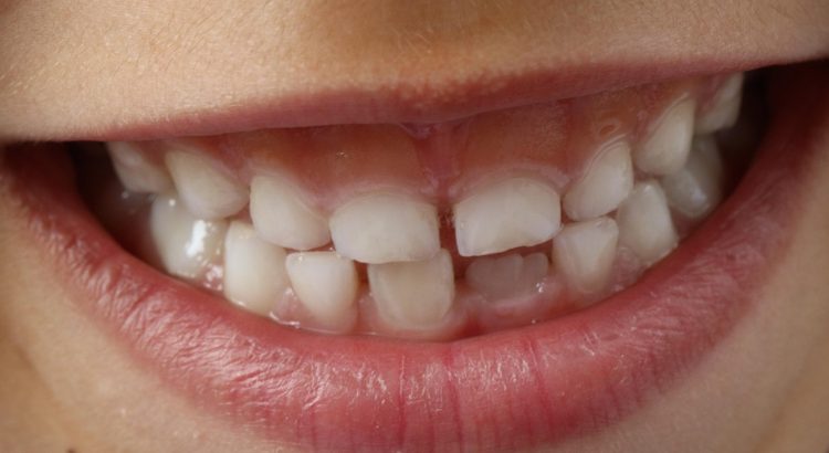 Teeth, child smile, child — The Art of Dental Beautification: Enhancing Your Smile with Modern Techniques