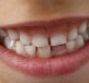 Teeth, child smile, child — The Art of Dental Beautification: Enhancing Your Smile with Modern Techniques